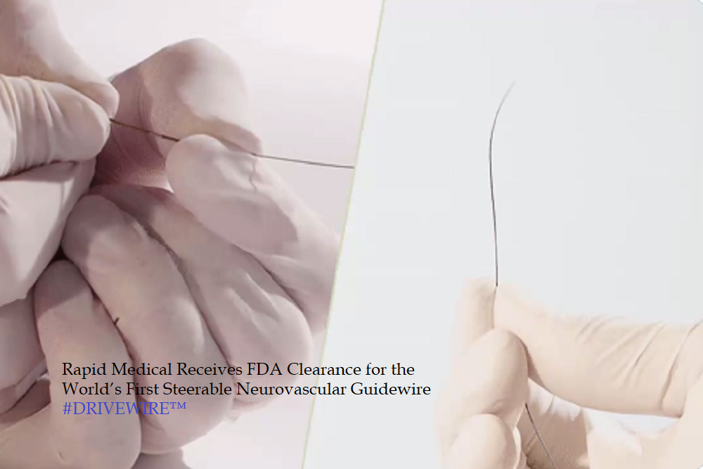 RAPID MEDICAL: Receives FDA Clearance for the World’s First Steerable Neurovascular Guidewire