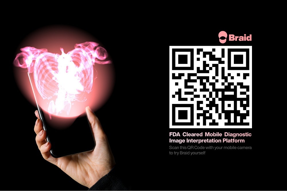 Braid App on an iPhone