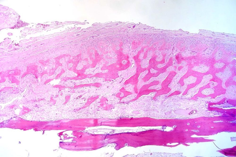 LOCATE BIO: CognitOss Granted FDA Breakthrough Device Designation